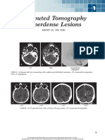 Chapter 1 CT Hypertensity Lesion