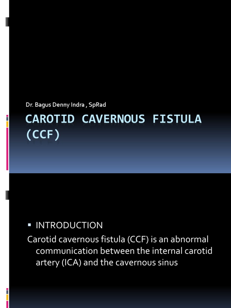 Carotid Cavernous Fistula Overview | PDF | Angiography | Angiology