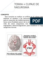 Craneotomia + Clipaje de Aneurisma