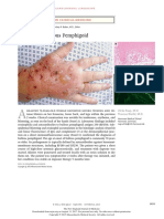 Bullous Pemphigoid: Images in Clinical Medicine