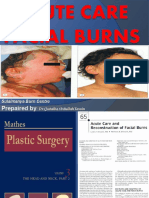 Acute Care Facial Burns