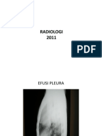 KELAS BESAR RADIOLOGI RESPI.pptx