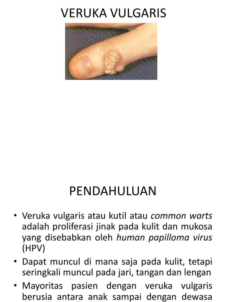 papilloma virus verruca genitale)