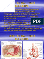 7.ulcerul G-D