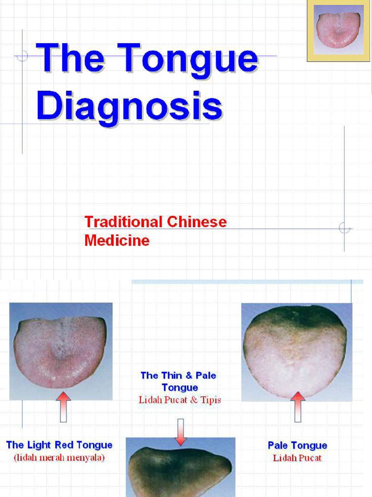 Tongue Diagnosa PDF