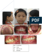 Nama: Az Zahrah Putri Umur: 9 Tahun DRG: Aditya Wisnu Drg. Op: Alfin Bahida