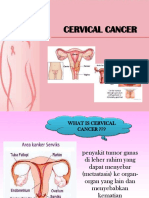 Kanker Serviks Penyuluhan