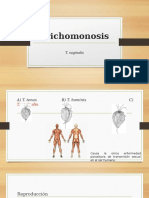 Trichomona Vaginalis 