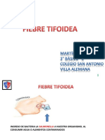 fiebre tifoidea