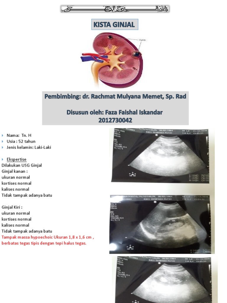 Download 63+ Gambar Ginjal Normal Dan Tidak Normal Terbaru Gratis