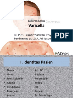 Varicella