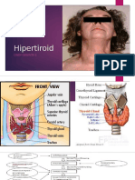 Hipertiroid RSMW