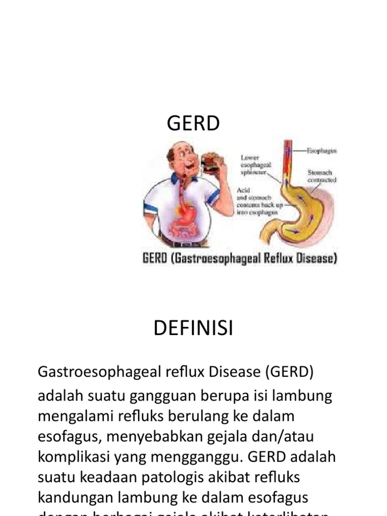 Gerd | PDF | Kesehatan Holistik
