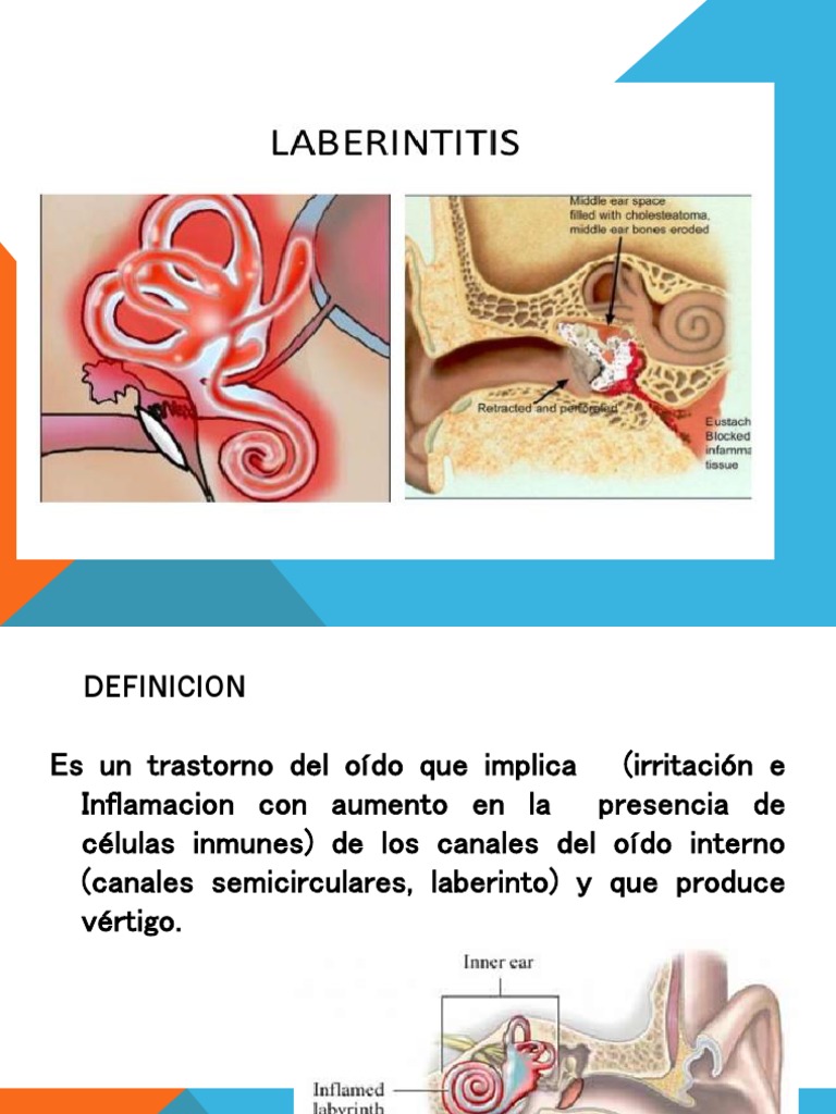 Laberintitis | PDF | Especialidades Medicas | Enfermedades y trastornos