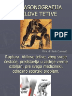 Ultrasonografija Ahilove Tetive