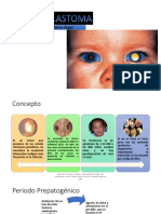 Retinoblastoma 