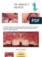 Frenillos bucales: técnicas quirúrgicas y patologías