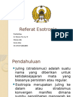 Esotropia: Referat Lengkap tentang Penyakit Juling ke Dalam