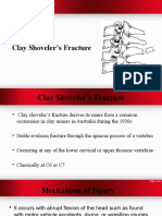 Clay Shoveler's Fracture