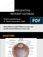 Presentasi Referat Katarak