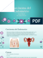 carcinoma del endometrio presentacionn