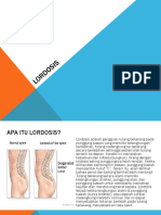 Lordosis