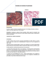 Patogenia del edema pulmonar: causas, mecanismos y diagnóstico