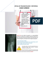 Aula Virtual de Traumatología y Ortopedia - Consolidacion Osea