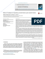 Article: MicroCT Analysis of Naturally Arrested Brown Spot Enamel Lesions