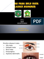 Kelainan Pada Bulu Mata (Eyelashes Disorder)