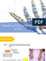 Carpal Tunnel Syndrome (CTS)