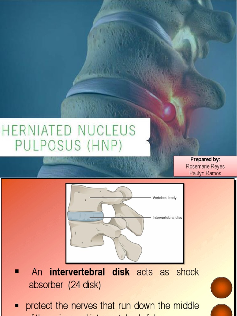 Herniated N P | PDF | Musculoskeletal System | Neurology