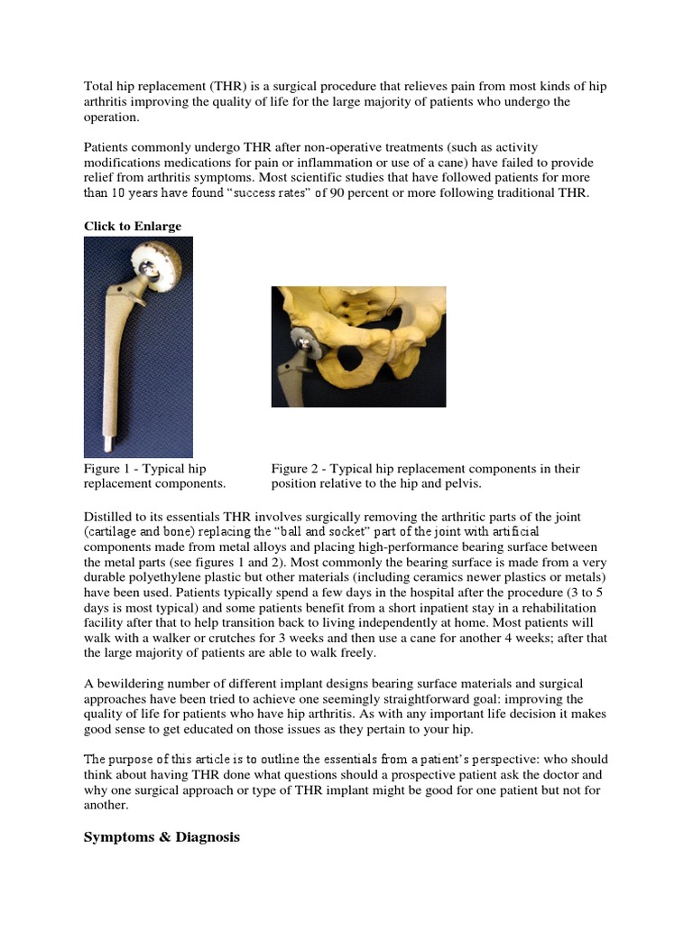 Understanding Total Hip Replacement | PDF | Arthritis | Surgery