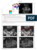 The Normal Uterus