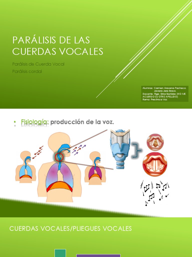 Parálisis de Las Cuerdas Vocales Otorrinolaringología