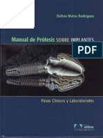 Manual de Protesis Sobre Implantes - Matos PDF