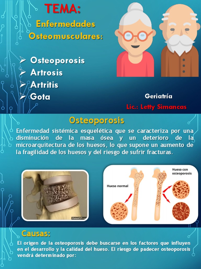 Adulto Mayor Cuidados de Enfermeria | Osteoporosis | Osteoartritis