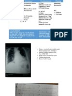 NKS/P/7 1th/batu An/4156 24/ 19.40 Wita/ PPOK Eksaserbasi Akut + Susp. Pneumonia Spirometri