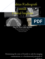 Dental Implant novo.pptx