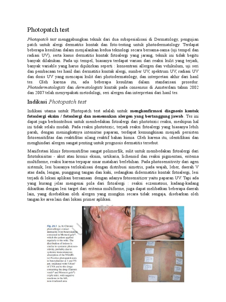 Photopatch Test | PDF