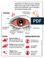 CONJUNTIVITIS