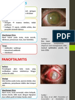 Endoftalmitis and Panoftalmitis