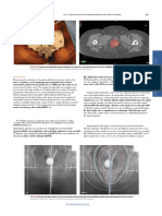 473-500Perez and Bradys Principles and Practice of Radiation Oncology_booksmedicos.org.en.es
