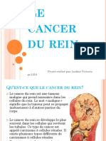 Le Cancer Du Rein