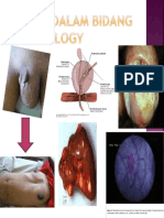 UROONCOLOGI