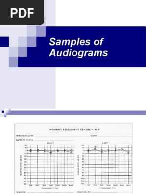 AudioGram