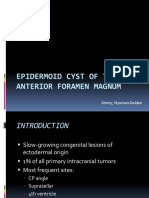 Epidermoid Cyst of The Anterior Foramen Magnum Presentation