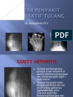 Radiologi Artropati Reumatoid