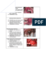 Tumores Odontogenicos Epiteliales