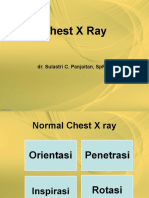 Chest X Ray New